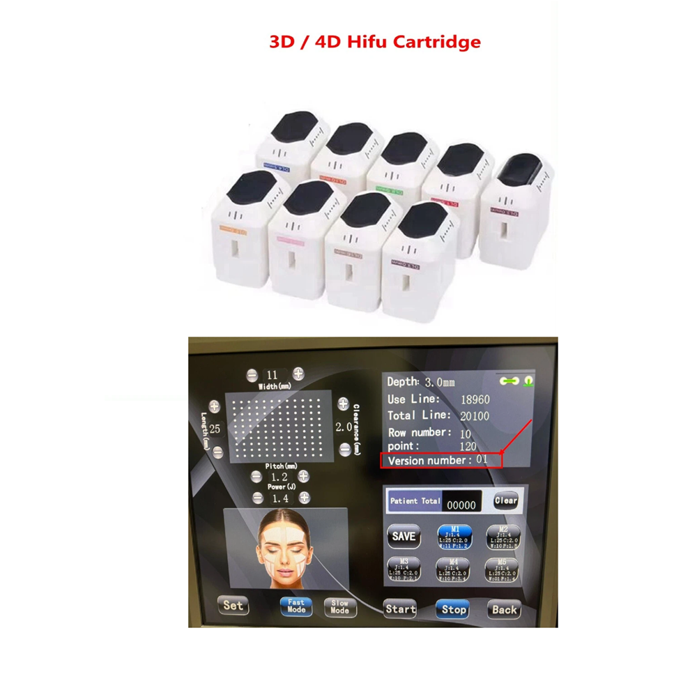 Kartrid HIFU 5D 3D 4D / Pengen - Vaginal Tightening Hifu Machine ulasan dan harga