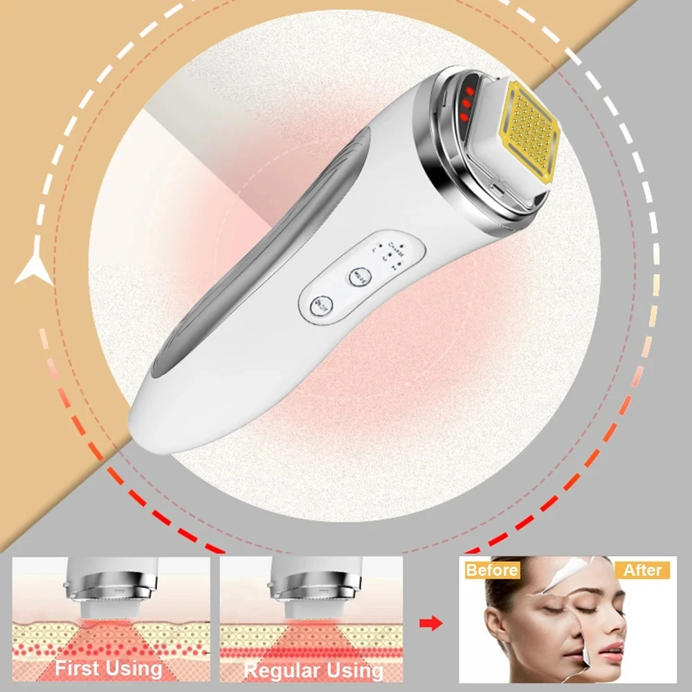 Perangkat Pengangkat Wajah Fre - Radio Frequency Face Lift Machine ulasan dan harga