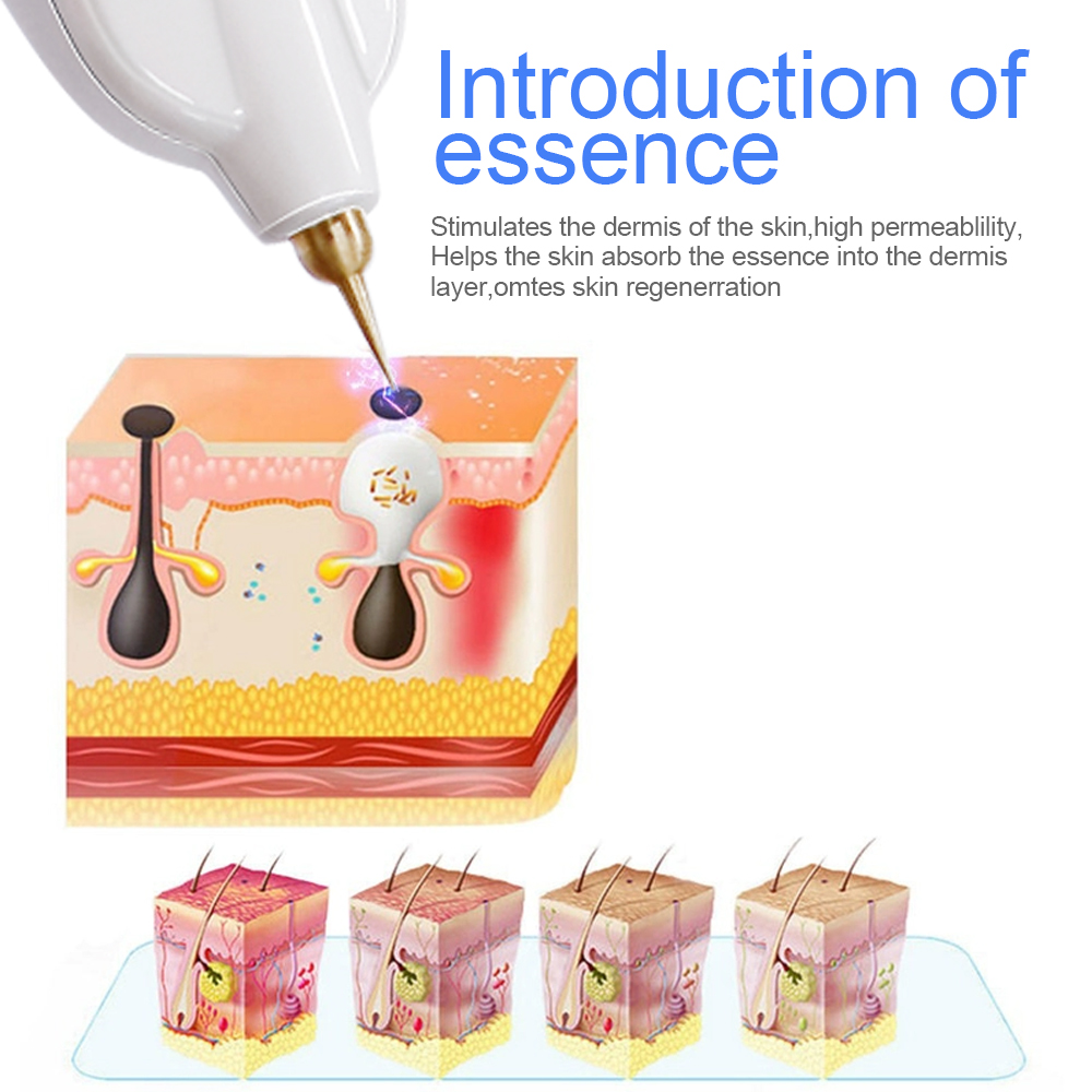 Ujung Jarum Pengganti Tembaga  - Plasma Pen Fibroblast Eyelid Lift ulasan dan harga