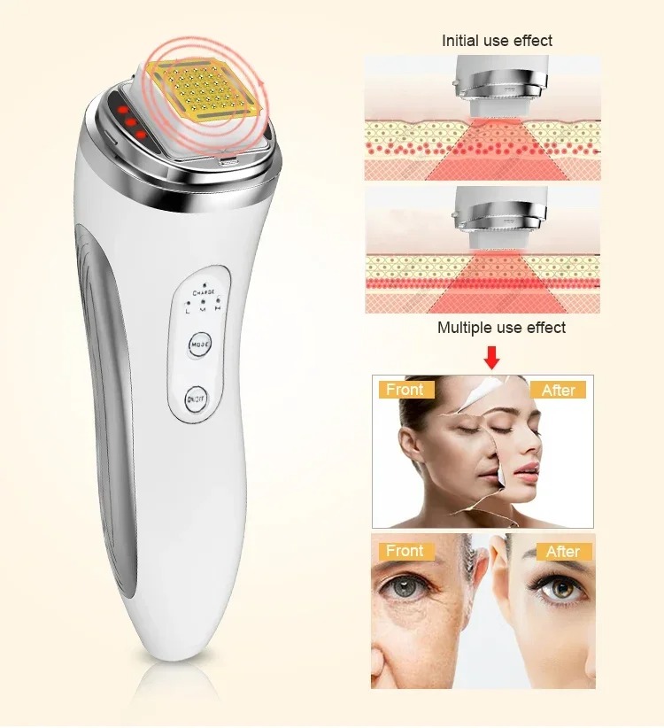 Alat Pengencang Wajah Frekuens - Radio Frequency Face Lift Machine ulasan dan harga