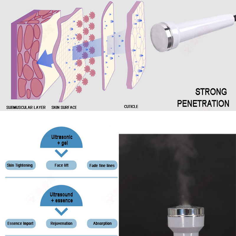Mesin Perawatan Kulit Wajah Ul - Anti Aging Ultrasound Face Machine ulasan dan harga